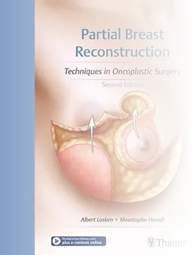 بازسازی جزئی پستان: تکنیک ها در جراحی انکوپلاستیک ۲۰۱۷
