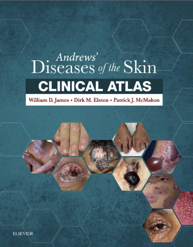 Andrews' Diseases of the Skin Clinical Atlas E-Book: Expert Consult ۲۰۱۶اطلس بالینی بیماری های پوست اندروز (نسخه الکترونیکی): مشاوره تخصصی ۲۰۱۶