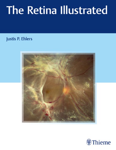 شبکیه مصور ۲۰۱۹