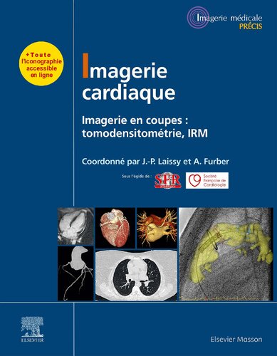 تصویربرداری قلب: تصویربرداری جام: توموگرافی کامپیوتری ، MRI