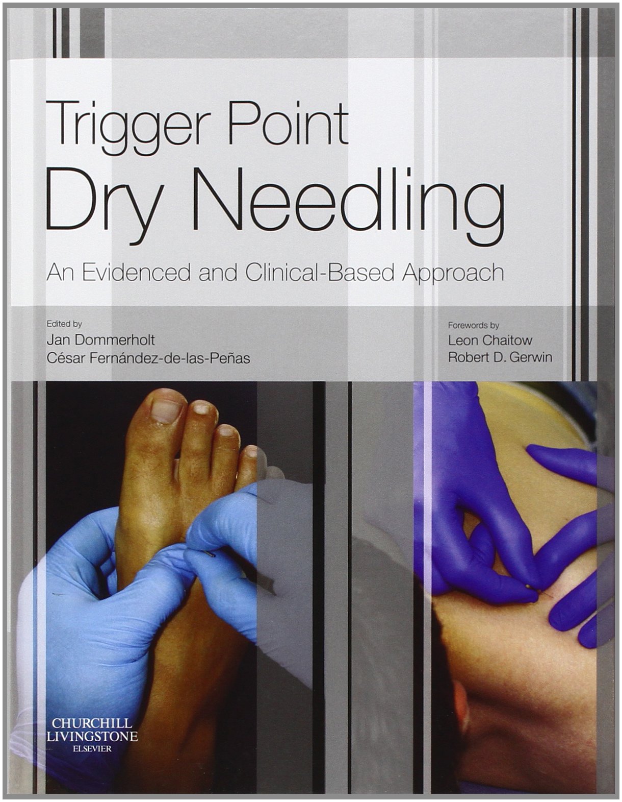 سوزن زنی خشک نقاط ماشه ای: رویکرد مبتنی بر شواهد و بالینی ۲۰۱۳