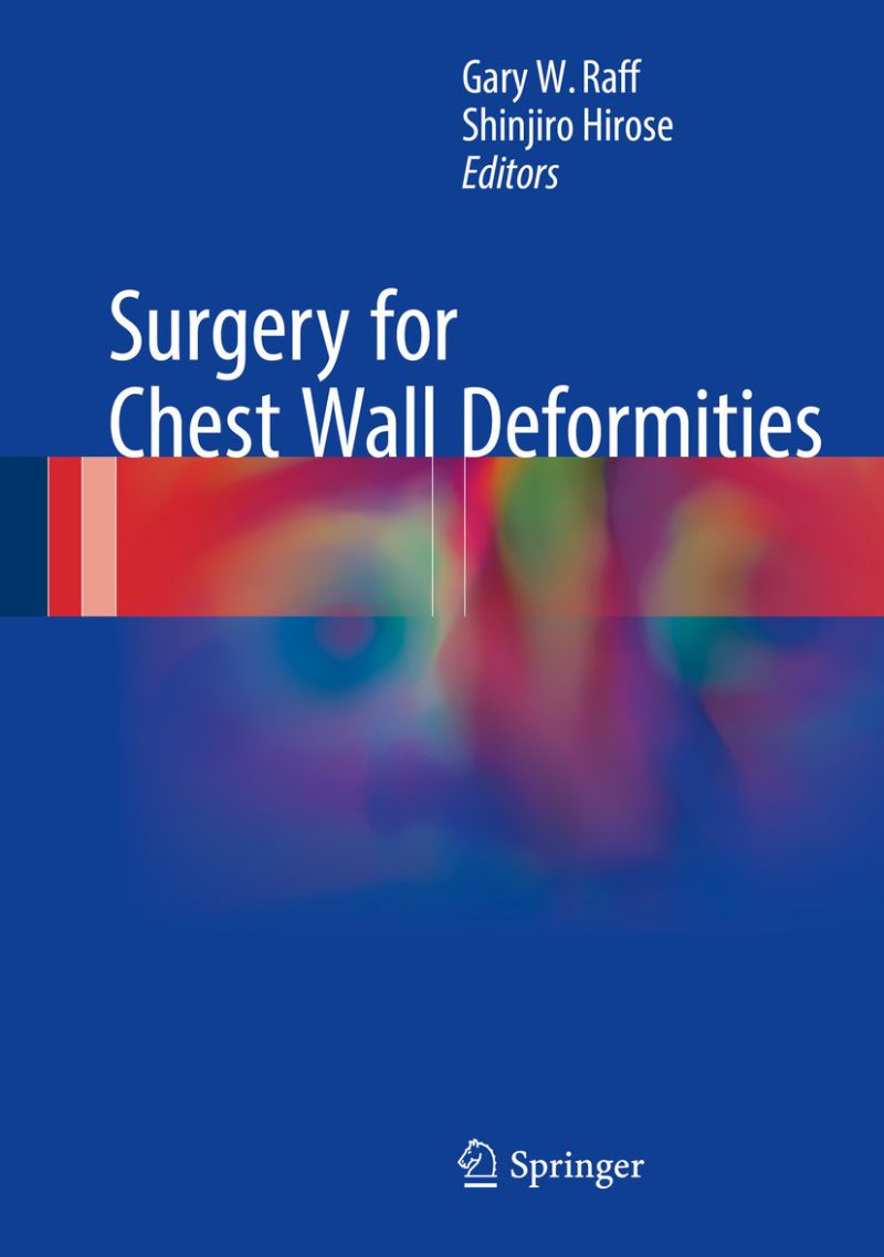 جراحی برای تغییر شکل قفسه سینه ۲۰۱۶