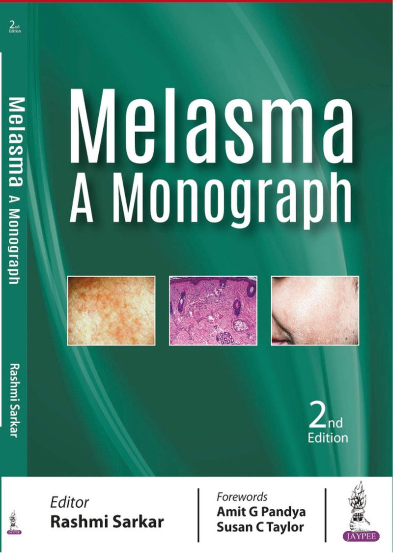 ملاسما: یک مونوگرافی