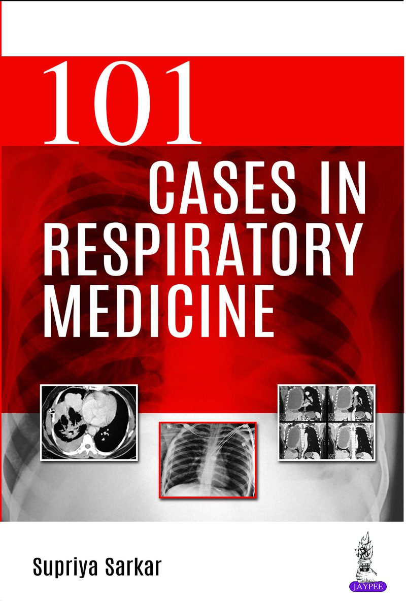101 مورد در پزشکی تنفسی