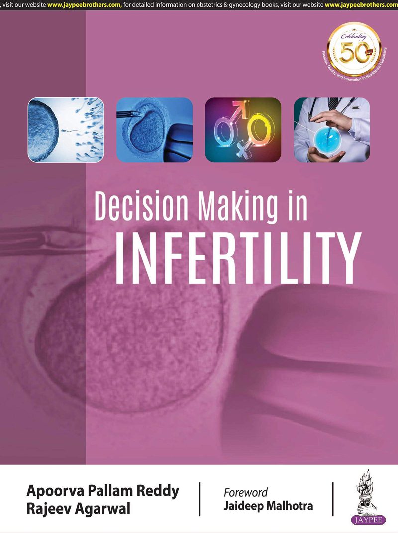 تصمیم گیری در ناباروری