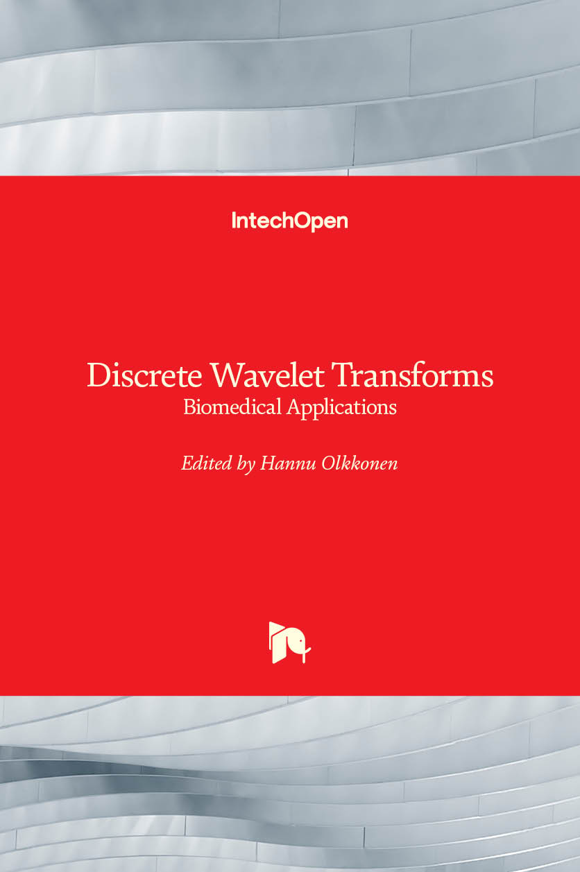 تبدیل موجک‌های گسسته